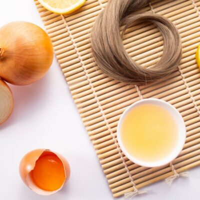 Top 5 home remedies for hair loss